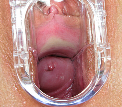 Iris in #282 from In The Crack